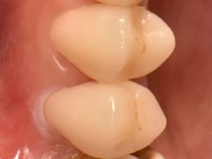 -精德口腔·种植修复·儿牙中心(财富中心店)