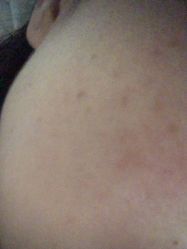 体验后-武汉颜范薇美医疗美容门诊部