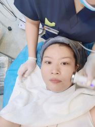 体验前-More摩尔医美の注射线雕光电中心