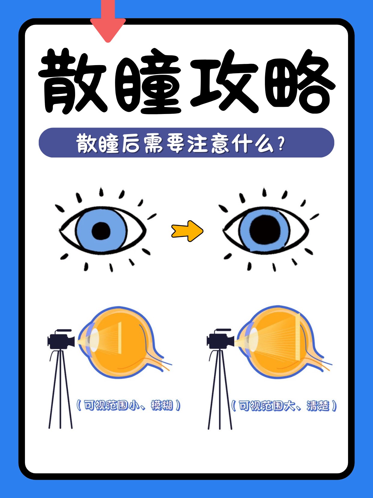为什么尽量别去散瞳