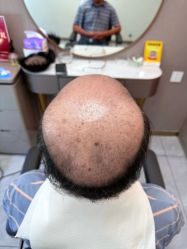 -唐风采假发补发定制