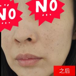点击看大图 -痣斑堂·取大痣