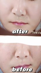 -紫御国际抗衰ZOE ANTI AGING