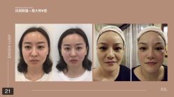 -安吉拉青春化管理中心
