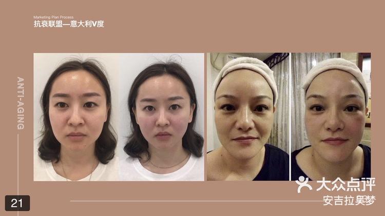 意大利v度-大众点评