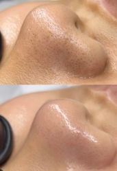 -春田皮肤管理中心品牌旗舰店