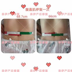 点击看大图 -亲伊通乳产后修复中心(航空港店)