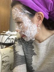 -北京米扬丽格医疗美容·联合丽格鼻整形中心