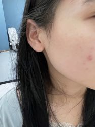 体验前-美瑞莎创美医疗美容