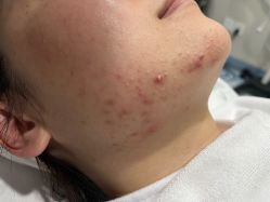 体验前-上海漾颜医疗美容