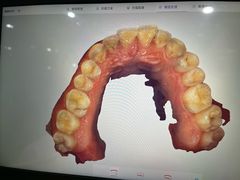 -土豆口腔(凤凰北总店)