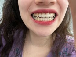 -厦门美莱整形美容医院