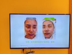 -塑青春&伊肤泉祛痘皮肤管理