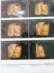 -潍坊艾玛妇产医院