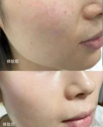 -联合丽格·张菡丽格医疗美容