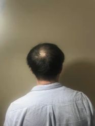-极客侠男士假发定制补发