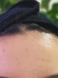 体验后-维秘形体医美 M·VVON医生集团