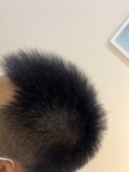 -雍禾植发全国连锁