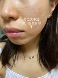 -清华大学玉泉医院-医疗美容科