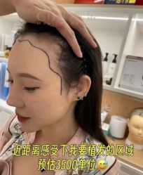 -熙朵美学植发·连锁品牌