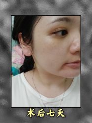 -东莞西妃整形美容医院