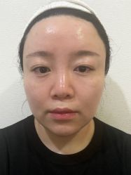-素美医疗美容·西南眼鼻整形·修复基地