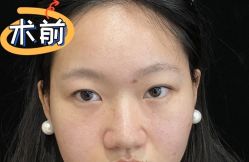 -素美医疗美容·西南眼鼻整形·修复基地