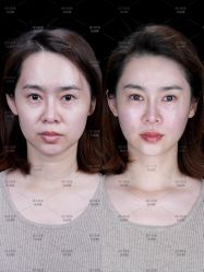 -美莱医学美容医院