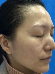 体验前-上海锦妍医疗美容门诊部