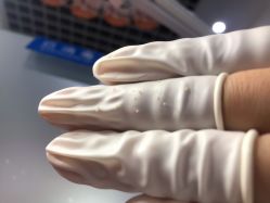 体验后-蕾特恩专业祛痘国际连锁