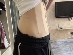 -成都西区医院整形美容