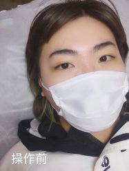 -西施无菌半永久纹绣眉眼影唇轻增发纹发际线