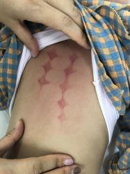 -季群小儿推拿(圣克拉店)