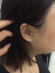 -肥三针腧穴瘦身馆