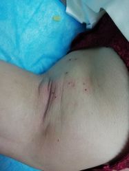 -叶美人医疗美容