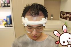 -大麦微针植发丨全国连锁