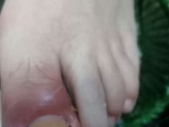 -祖传修脚甲沟炎灰指甲鸡眼