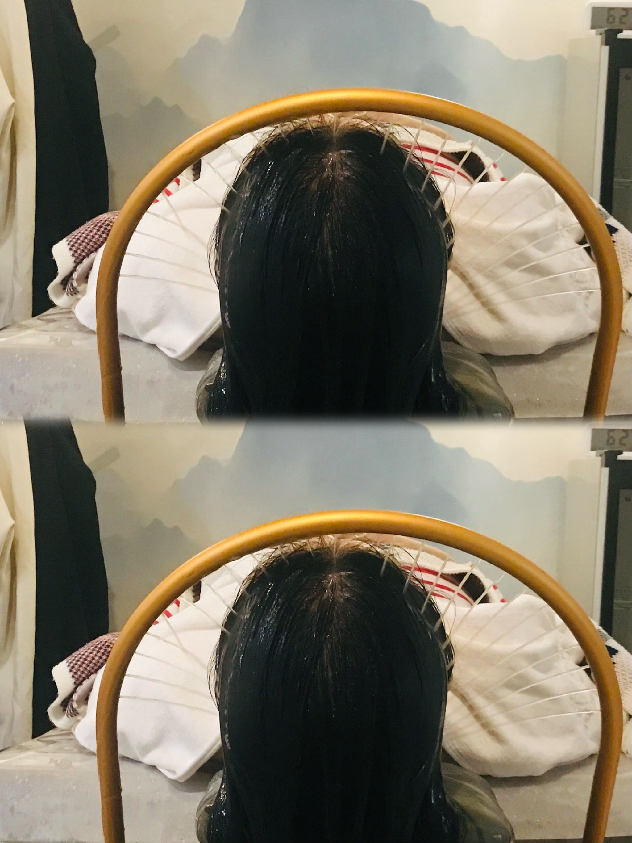 把洗头洗干净后再涂上姜泥用毛巾裹了一会有点热辣辣的感觉