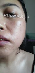 -新美荟医美·专注面部美学抗衰