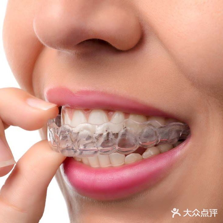 【科普】佩戴隐形牙套的注意事项