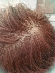 -熙朵美学植发·连锁品牌