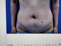 体验前-西安壹加壹医疗美容·西北抗衰旗舰店