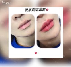 -Yestar艺星医疗美容医院