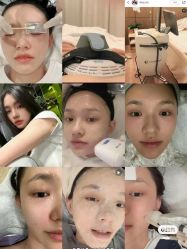 点击看大图 -DMK酶疗中心·BeautyYoung舒妍科技美肤