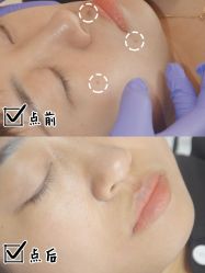 -清疣美疣·痣·斑净肤中心