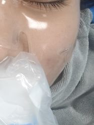 -新地崔劲松医疗美容