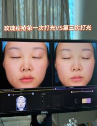点击看大图 体验前-石家庄苏亚美联臣医疗美容医院