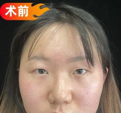 -素美医疗美容·西南眼鼻整形·修复基地
