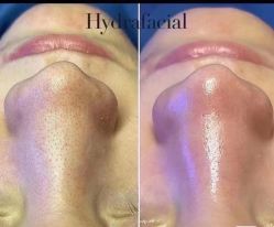 点击看大图 -栖SPA·ONDA ·美芙炫·海菲秀科技美肤中心