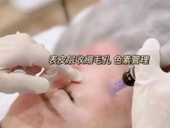 -苗方清颜痘肌研究所